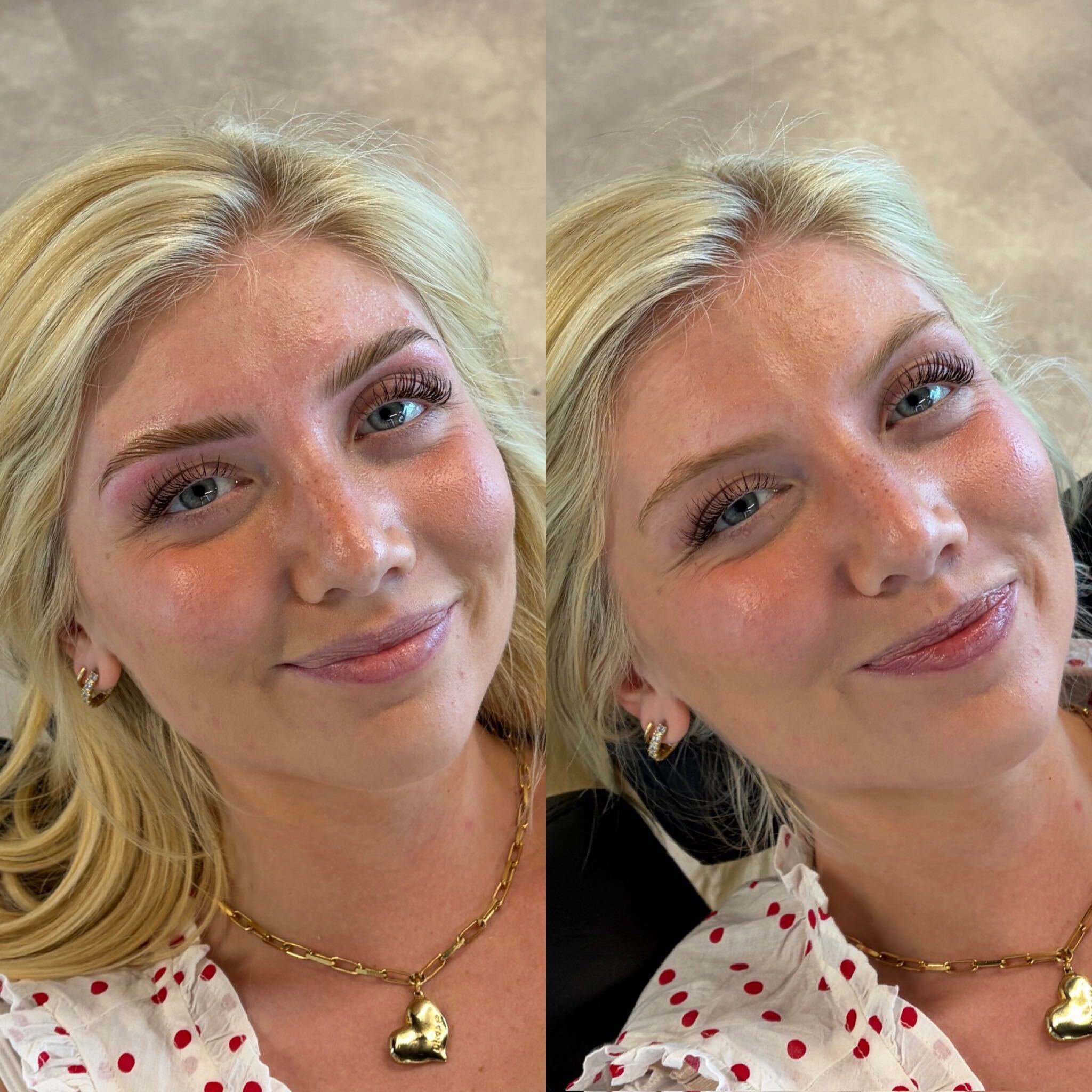 Brow comparison, studio comparison 1
