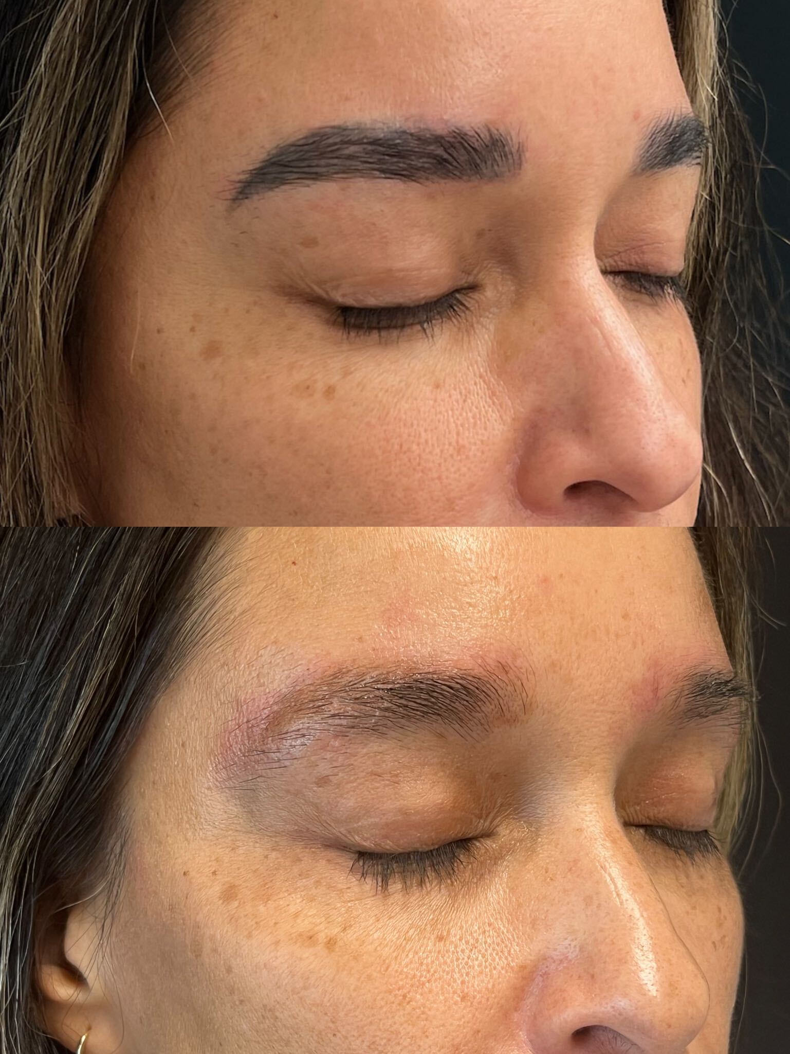 Microblading-removal progress, studio comparison 1